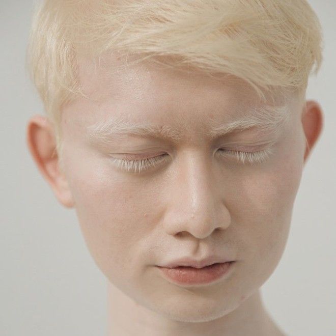 Как выглядят альбиносы разных национальностей и рас 44