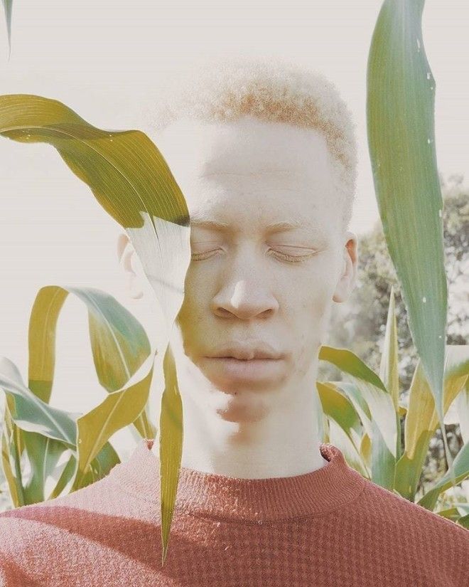 Как выглядят альбиносы разных национальностей и рас 49
