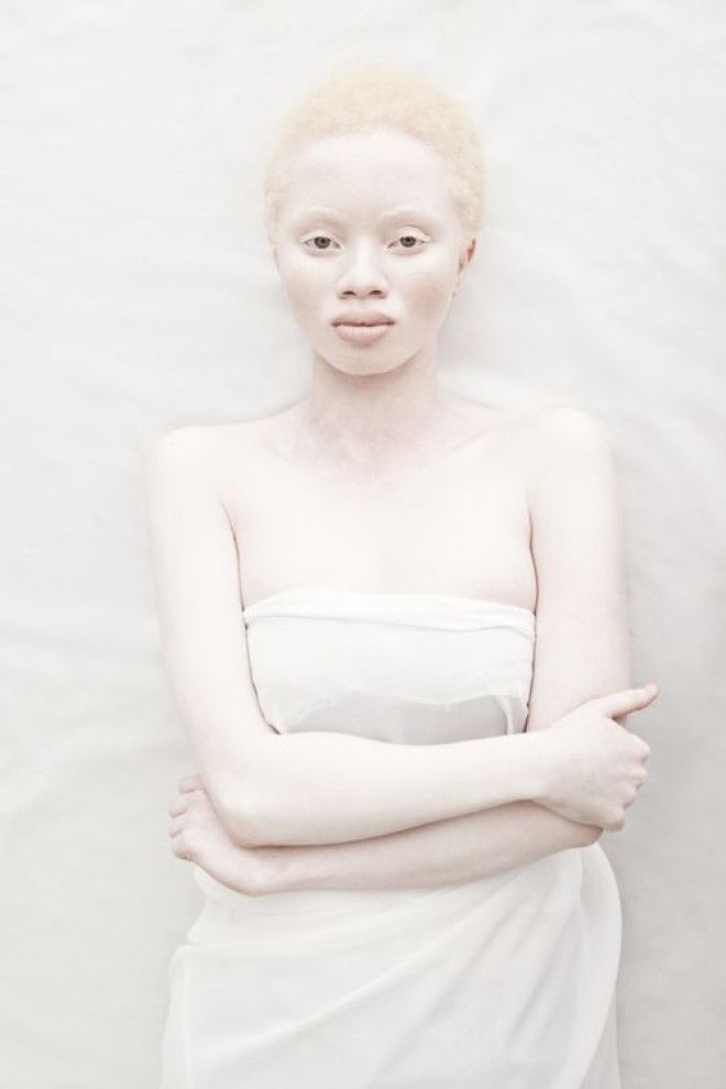 Как выглядят альбиносы разных национальностей и рас 50