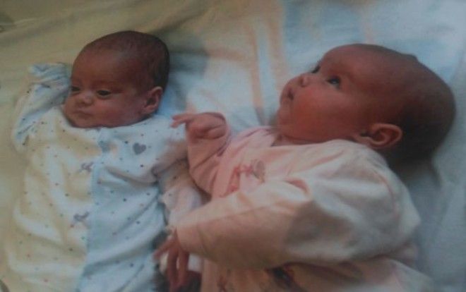 Связаны судьбой: чудо-близняшки, которые родились с перерывом в 87 дней 31