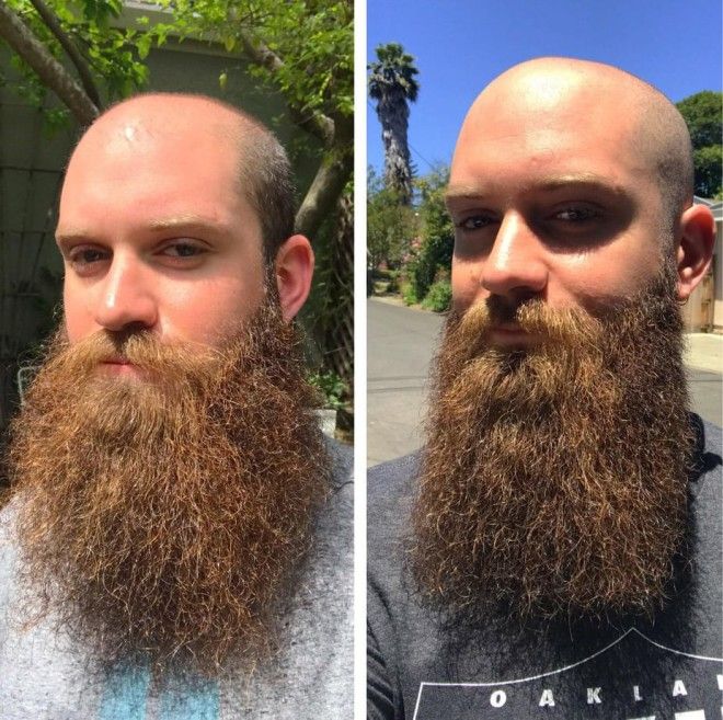20 фото показывающих разницу между ухоженной бородой и заброшенными кустами 50