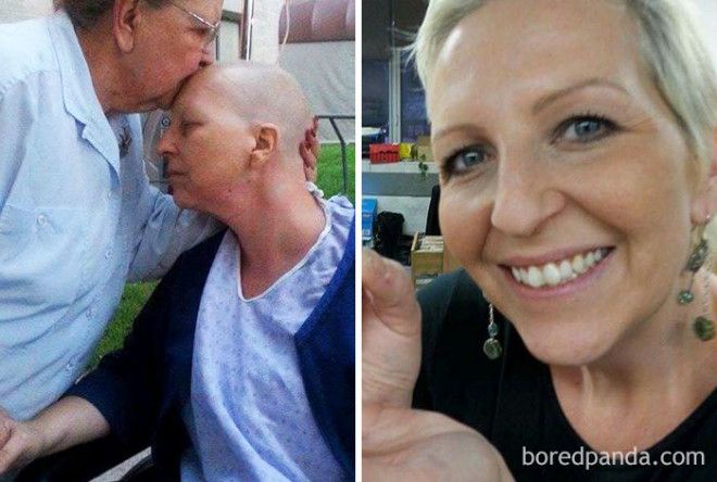 Люди, которые победили рак, в фотографиях до и после 49