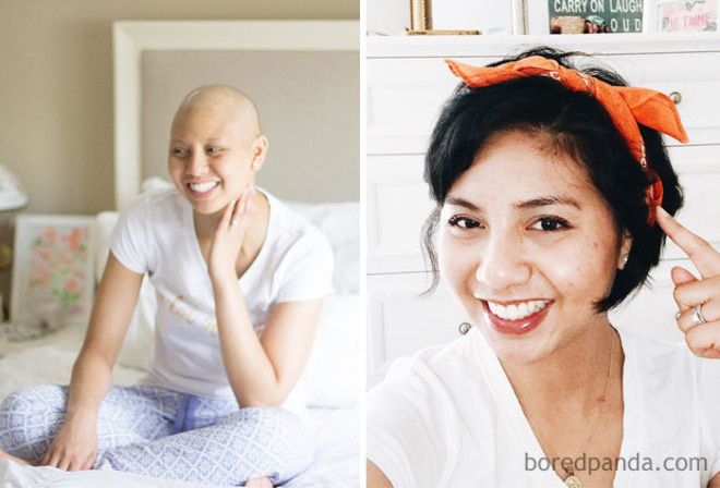 Люди, которые победили рак, в фотографиях до и после 50