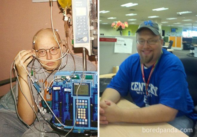 Люди, которые победили рак, в фотографиях до и после 45