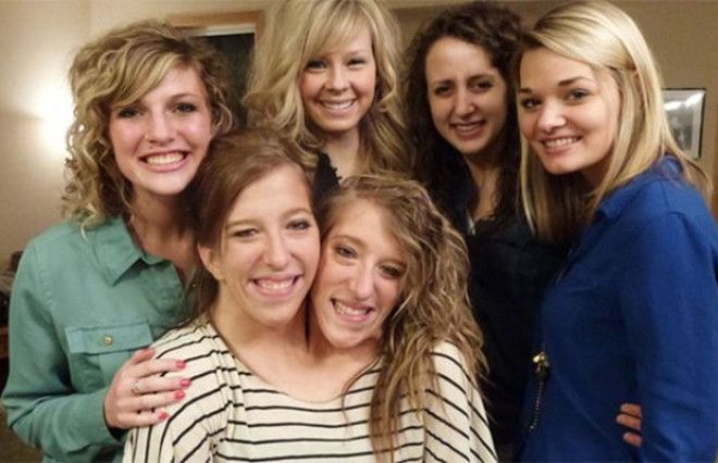 Удивительные 28-летние сёстры делят одно тело и одну зарплату преподавателя 48