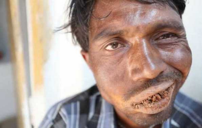 “Пожиратель кирпичей”: мужчина в Индии съел 5 тонн камней и не может объяснить зачем 26