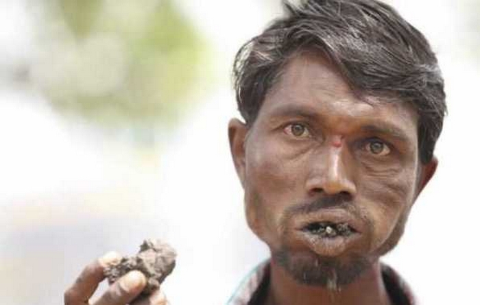 “Пожиратель кирпичей”: мужчина в Индии съел 5 тонн камней и не может объяснить зачем 27