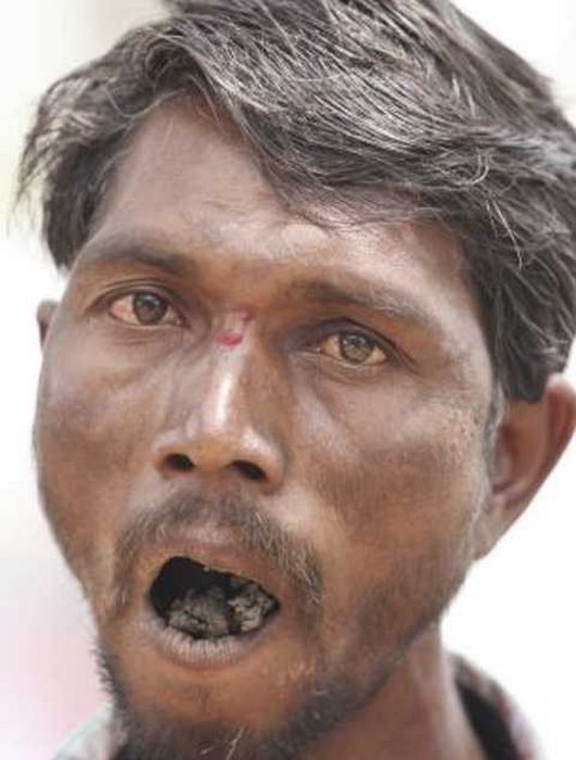 “Пожиратель кирпичей”: мужчина в Индии съел 5 тонн камней и не может объяснить зачем 29