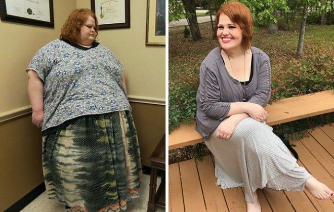 S14 фотографий До и После похудения Эти люди показали свою силу воли