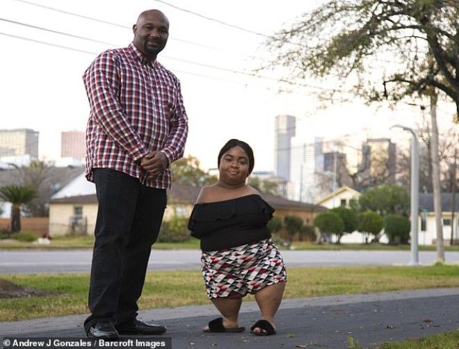 Девушка без рук и ног выходит замуж за полностью здорового мужчину 40