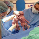 Эти близнецы покорили мир одним лишь снимком при рождении