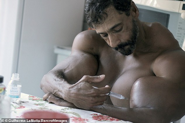 «На все ради красоты»: бразилец рискует жизнью, вводя в свои мышцы синтол 28