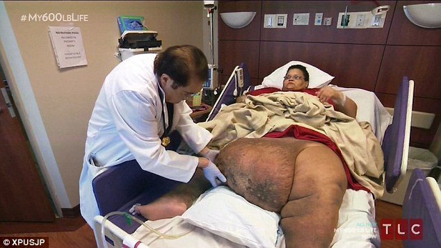 «Минус 270кг»: американке волшебным образом удалось похудеть в 5 раз 54