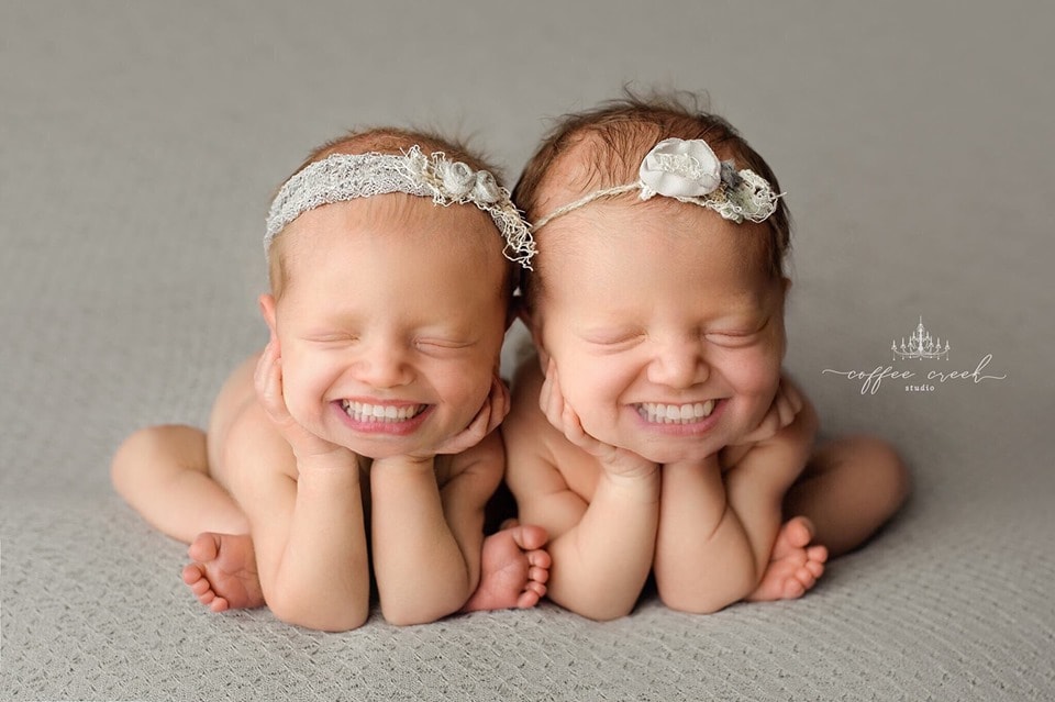 Фотограф из США приклеивает голливудские улыбки к снимкам младенцев. Зрелище, вызывающее мурашки 49