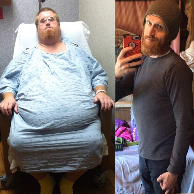 20 людей, которые распрощались с лишним весом и начали жизнь заново 69