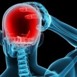 Как мгновенно остановить головную боль