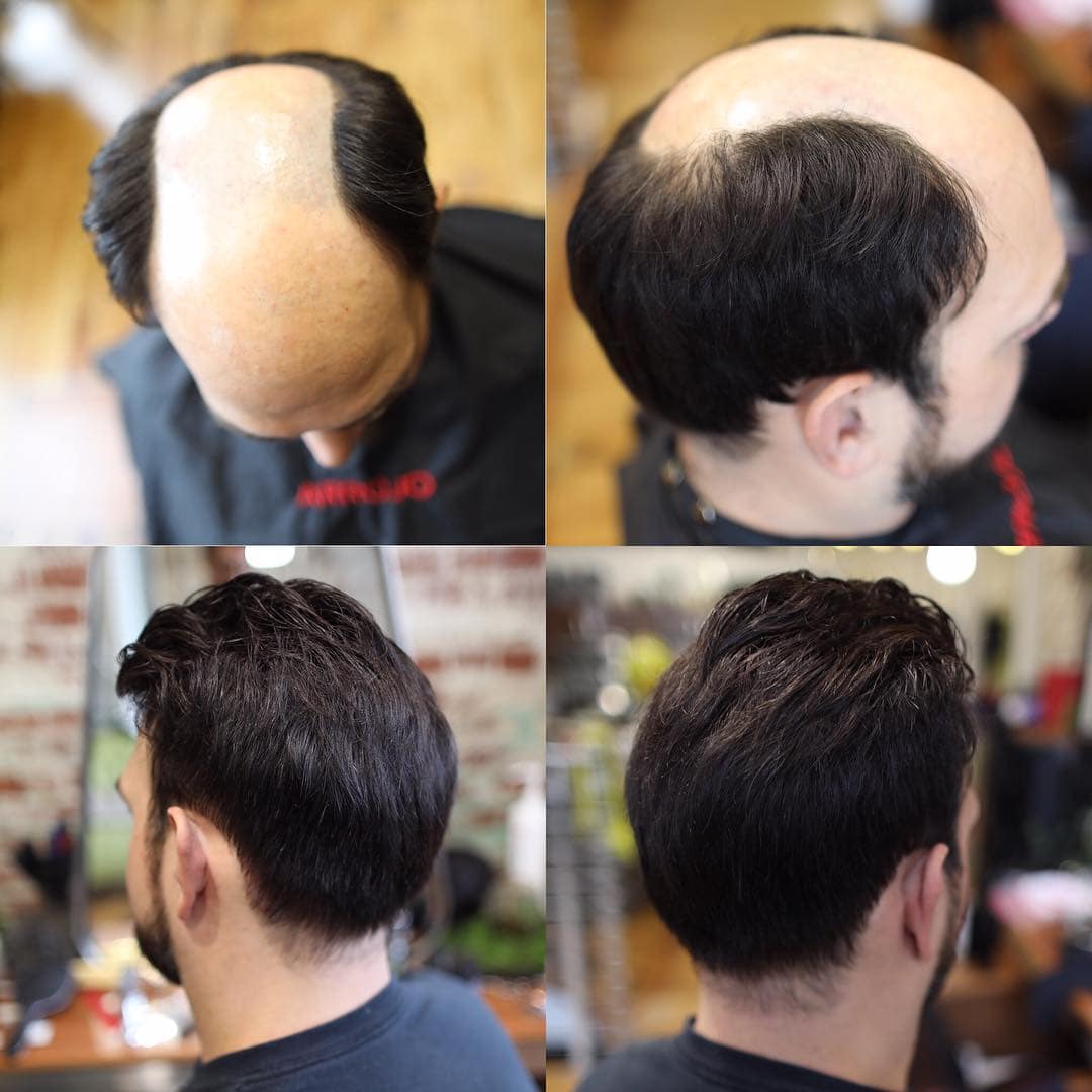 Парикмахер превращает лысины мужчин в шикарные причёски, и его клиенты от этого молодеют на глазах 55