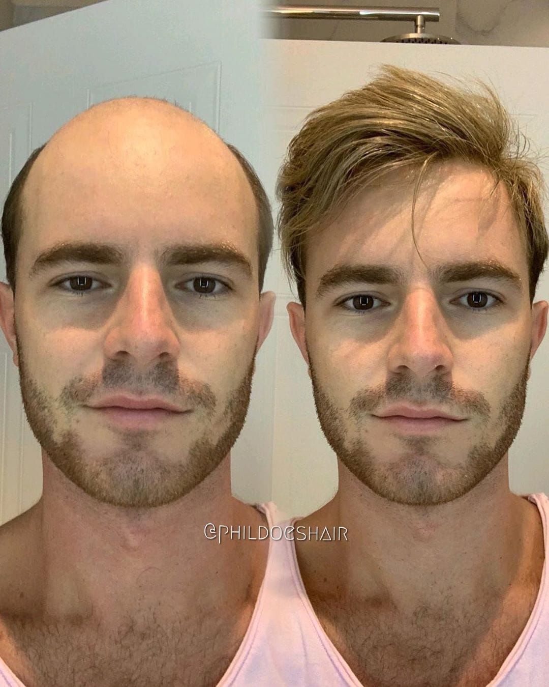 Парикмахер превращает лысины мужчин в шикарные причёски, и его клиенты от этого молодеют на глазах 61