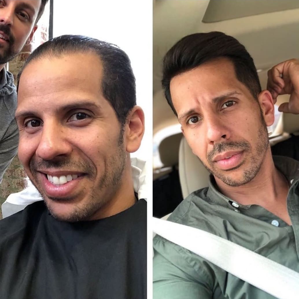Парикмахер превращает лысины мужчин в шикарные причёски, и его клиенты от этого молодеют на глазах 67