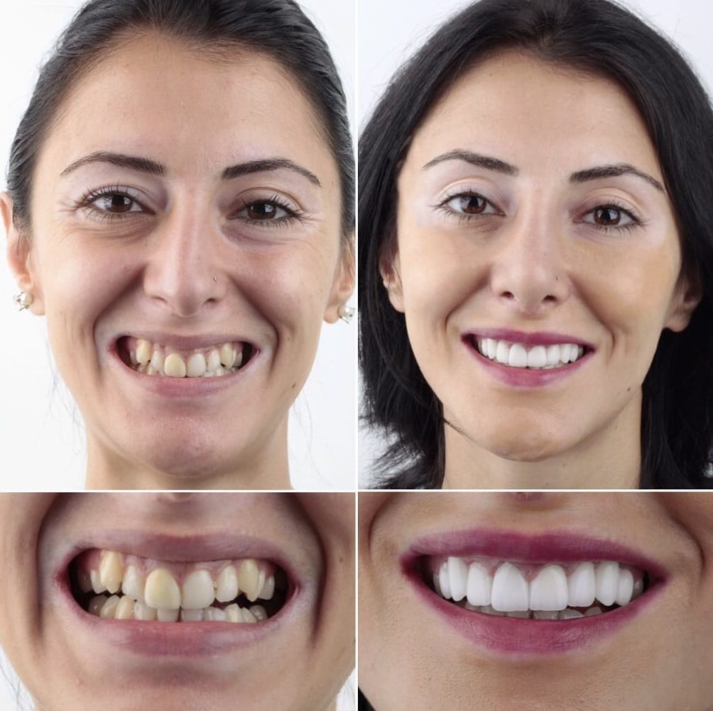 20 фотографий работ стоматолога, который даёт людям ещё одну причину улыбнуться 61