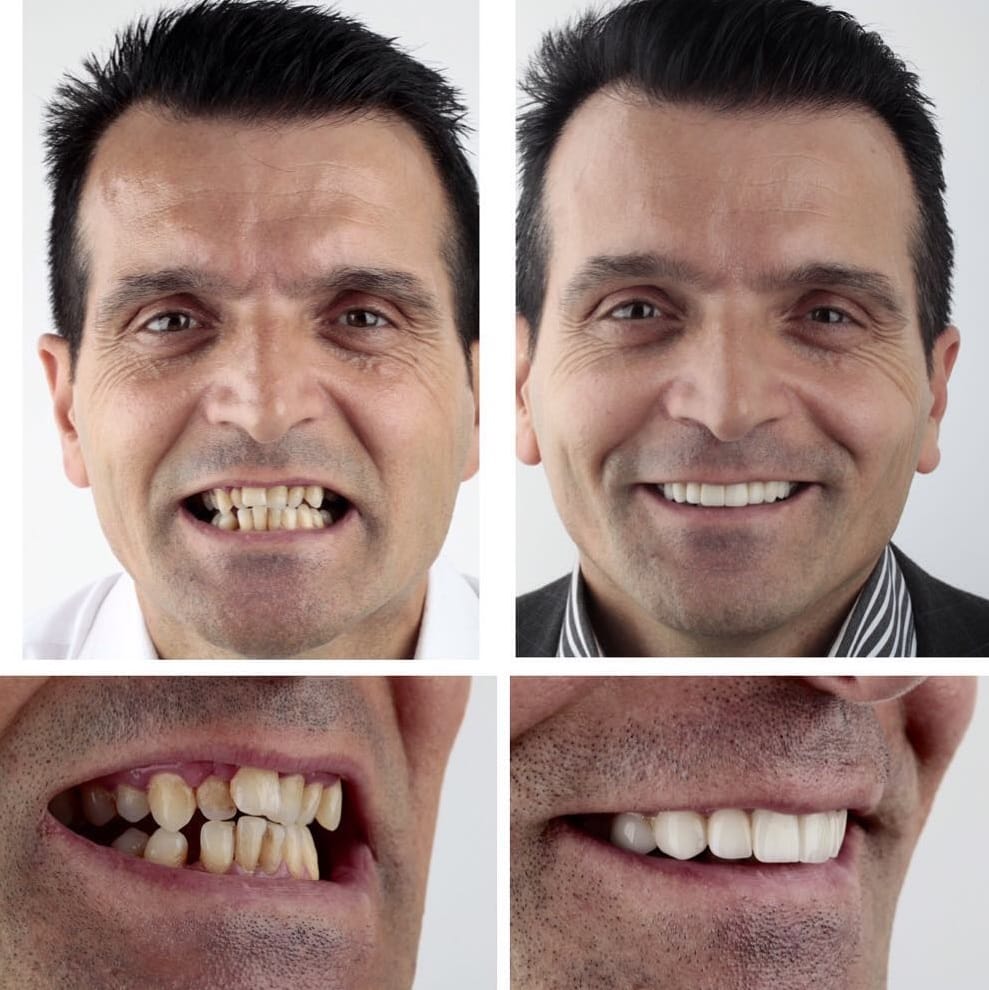 20 фотографий работ стоматолога, который даёт людям ещё одну причину улыбнуться 62
