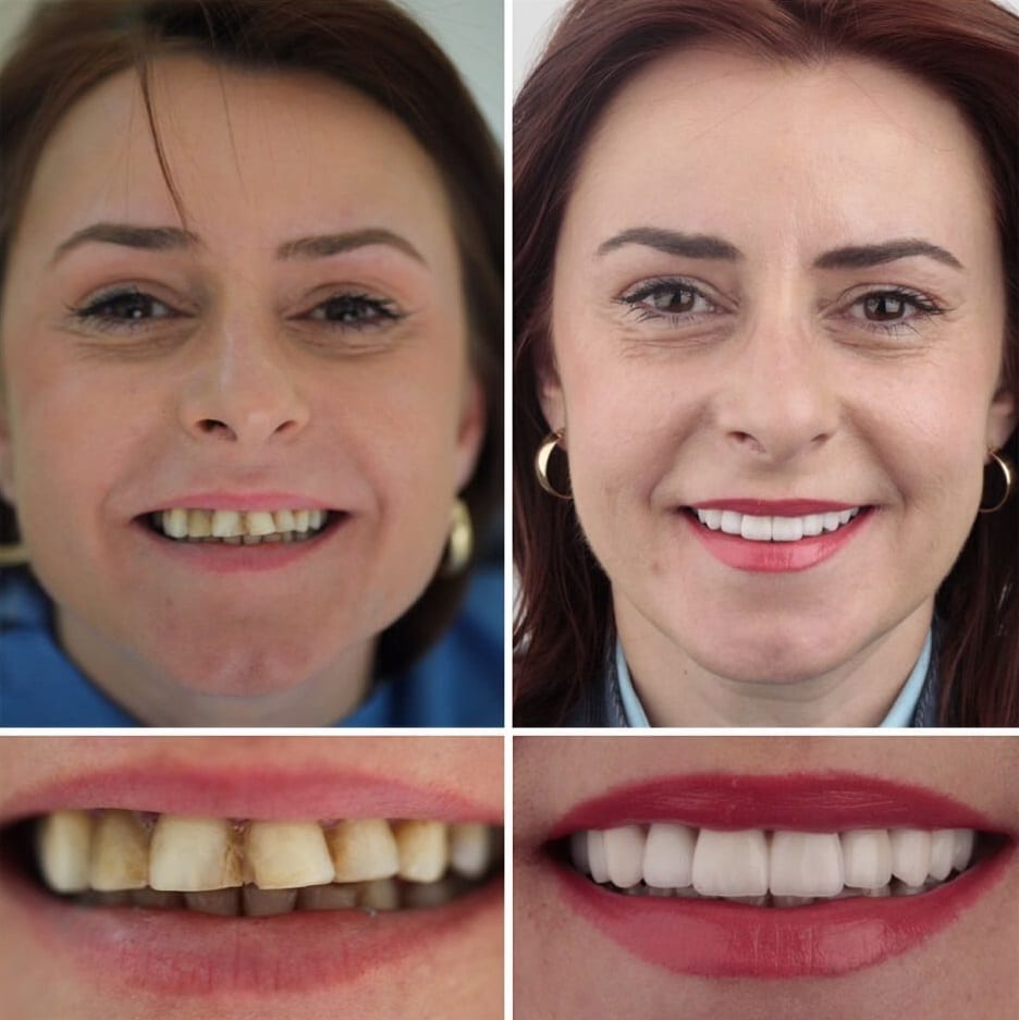 20 фотографий работ стоматолога, который даёт людям ещё одну причину улыбнуться 63
