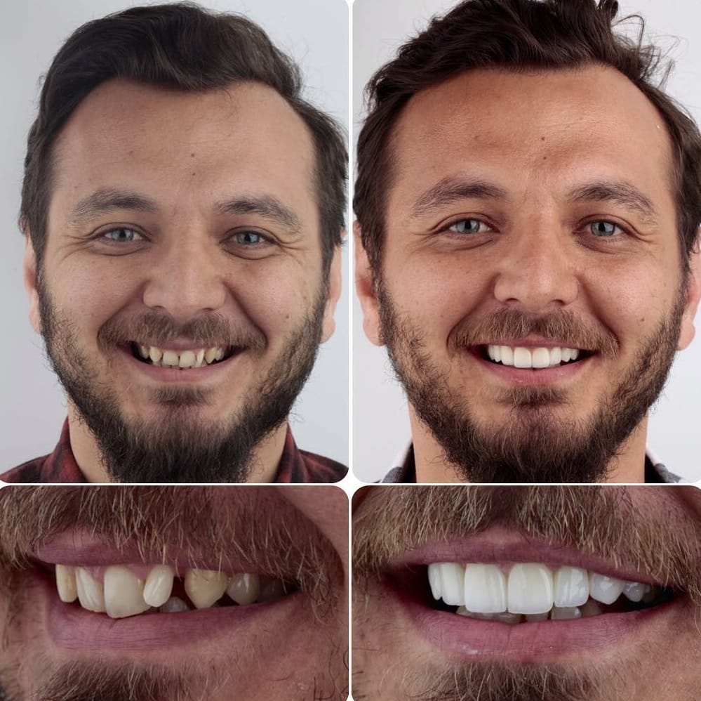 20 фотографий работ стоматолога, который даёт людям ещё одну причину улыбнуться 64
