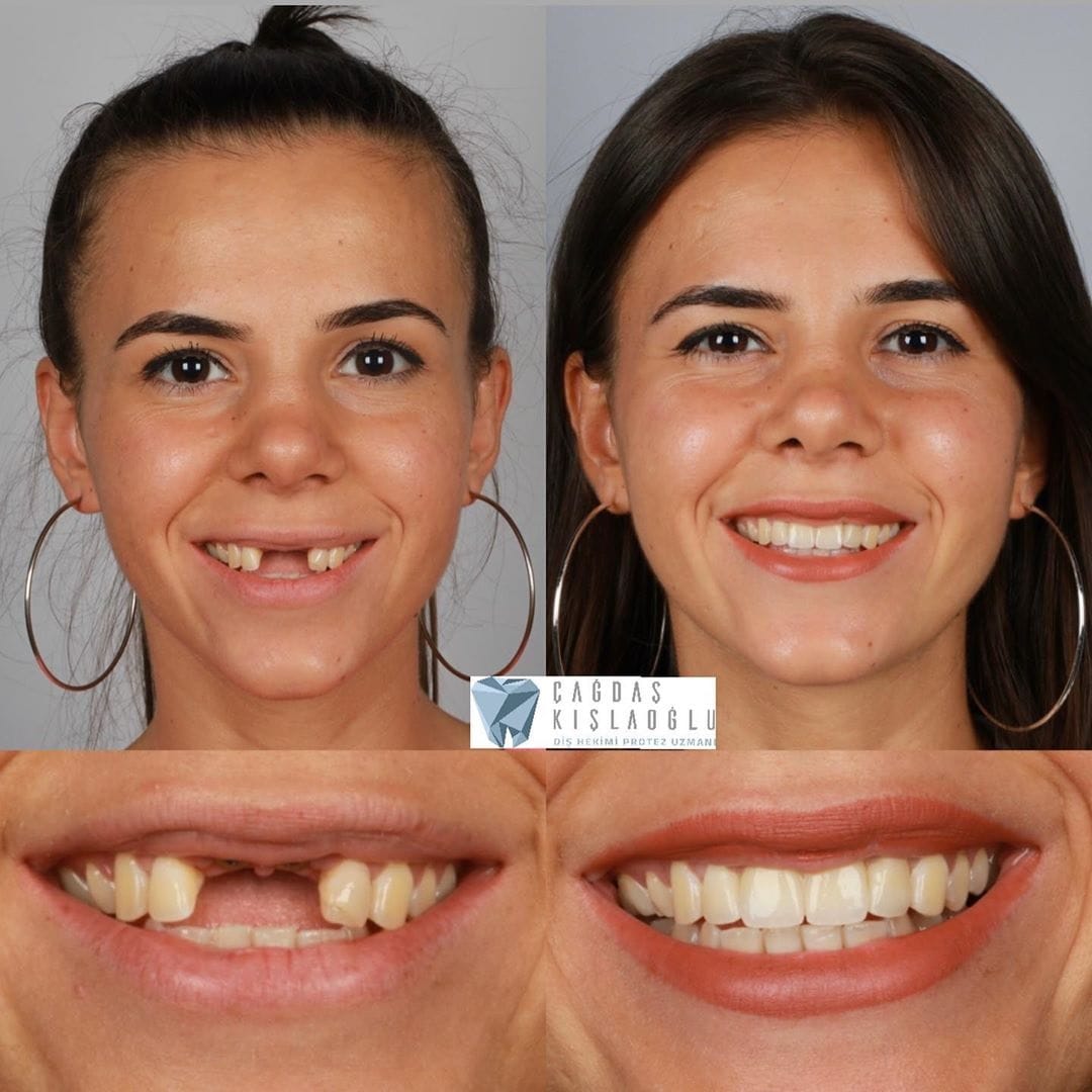 20 фотографий работ стоматолога, который даёт людям ещё одну причину улыбнуться 65