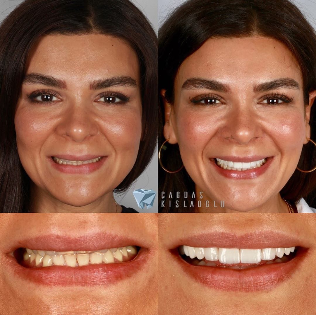 20 фотографий работ стоматолога, который даёт людям ещё одну причину улыбнуться 67