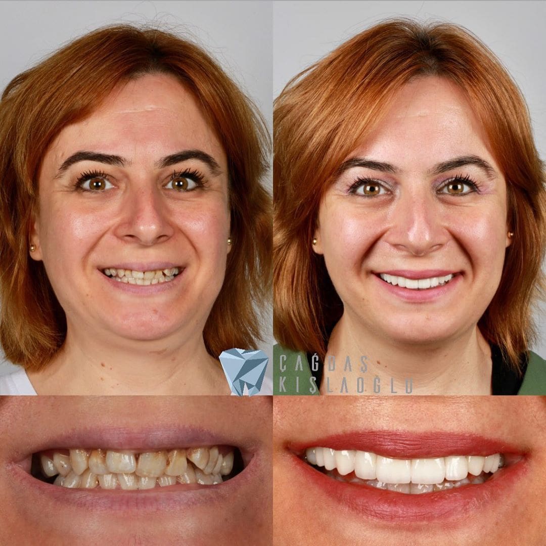 20 фотографий работ стоматолога, который даёт людям ещё одну причину улыбнуться 66