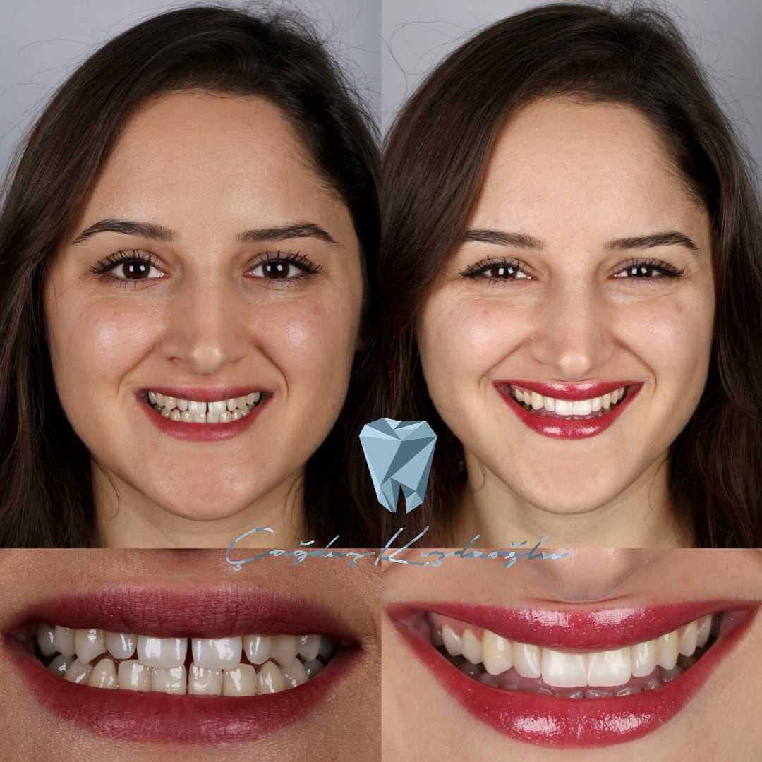 20 фотографий работ стоматолога, который даёт людям ещё одну причину улыбнуться 68
