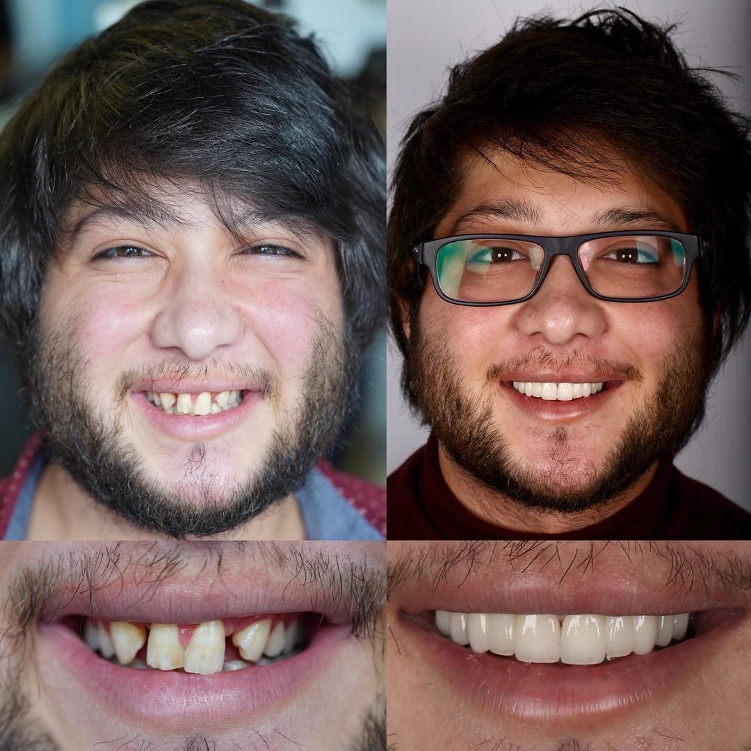 20 фотографий работ стоматолога, который даёт людям ещё одну причину улыбнуться 69