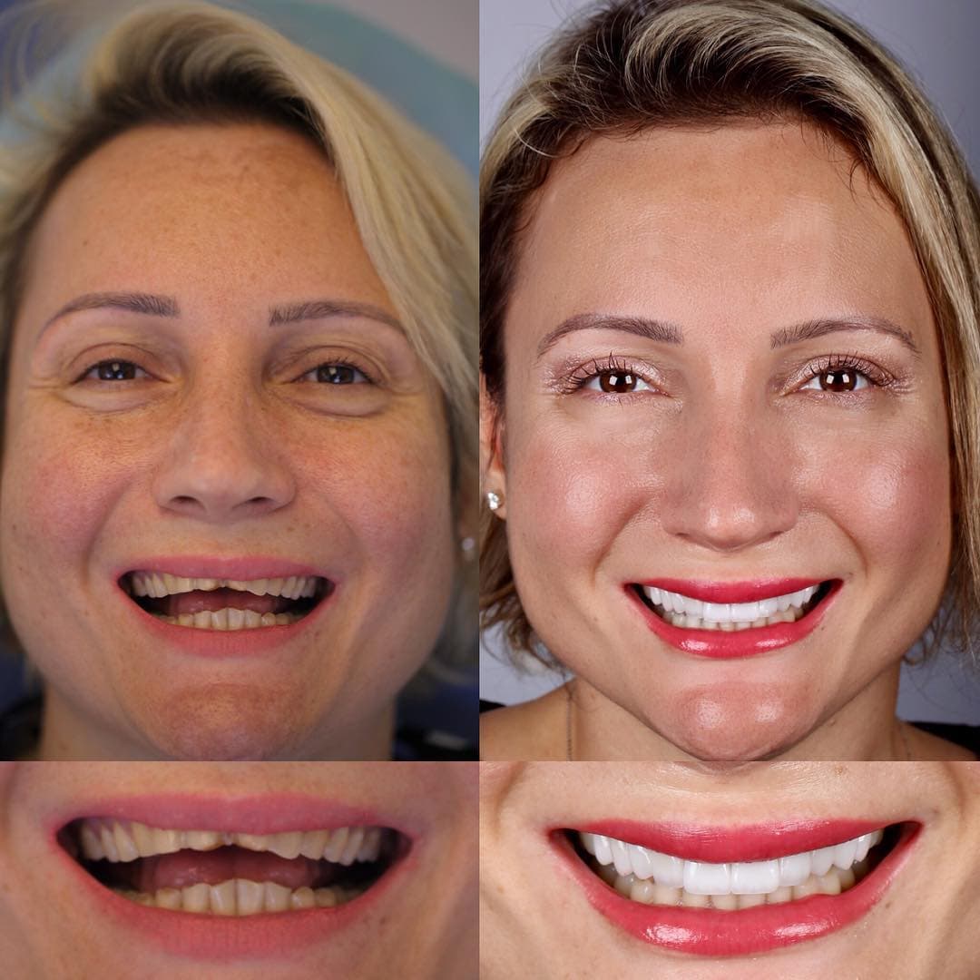 20 фотографий работ стоматолога, который даёт людям ещё одну причину улыбнуться 70