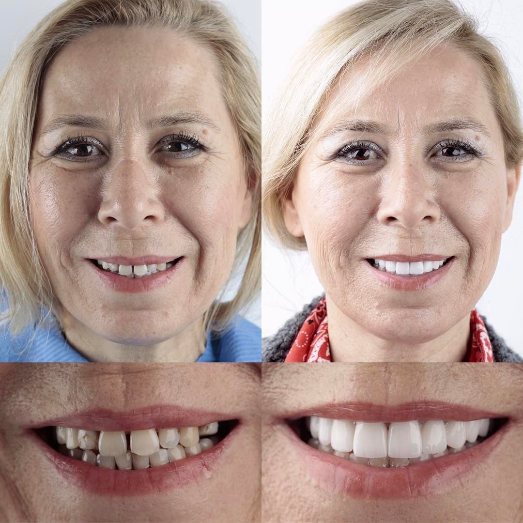 20 фотографий работ стоматолога, который даёт людям ещё одну причину улыбнуться 71