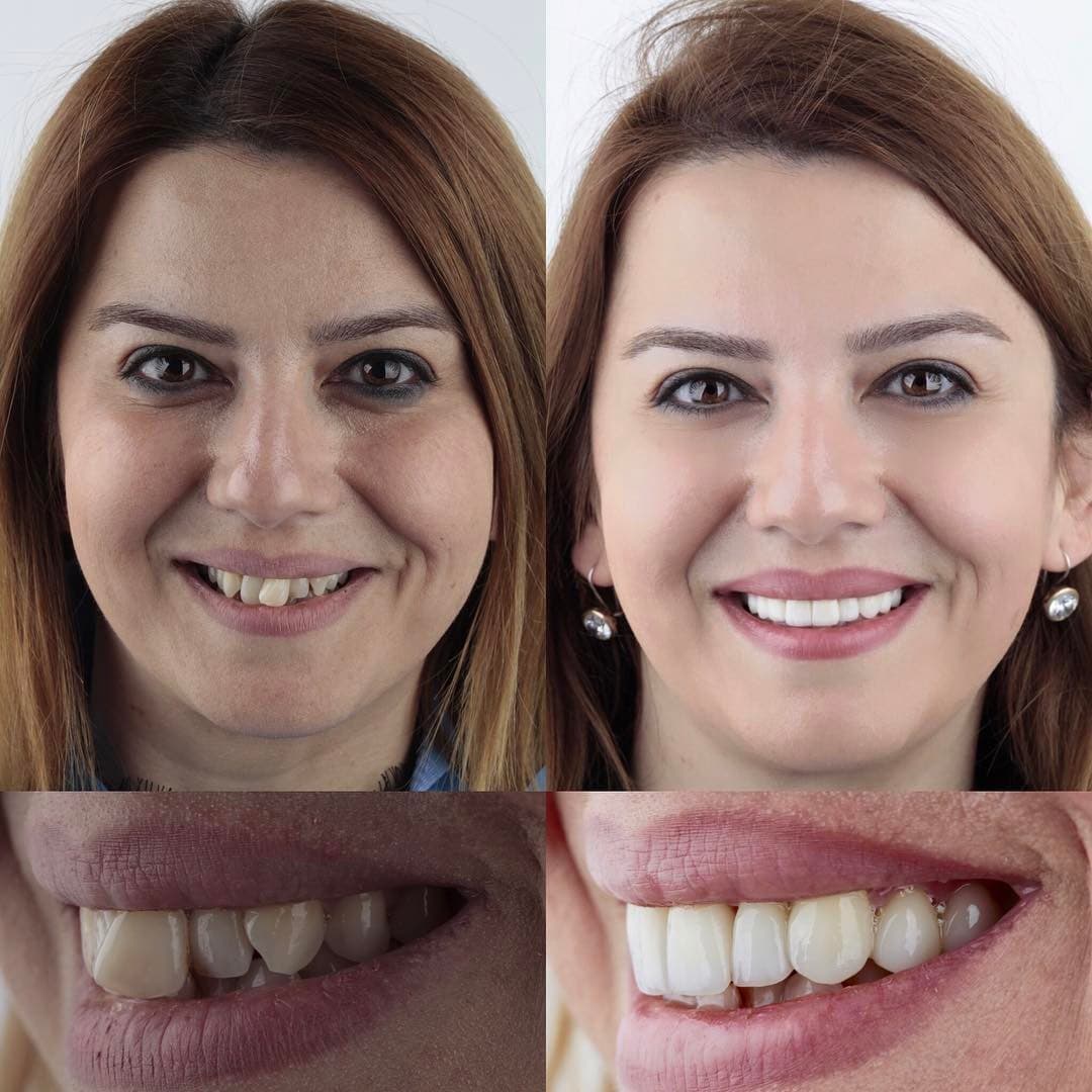 20 фотографий работ стоматолога, который даёт людям ещё одну причину улыбнуться 72