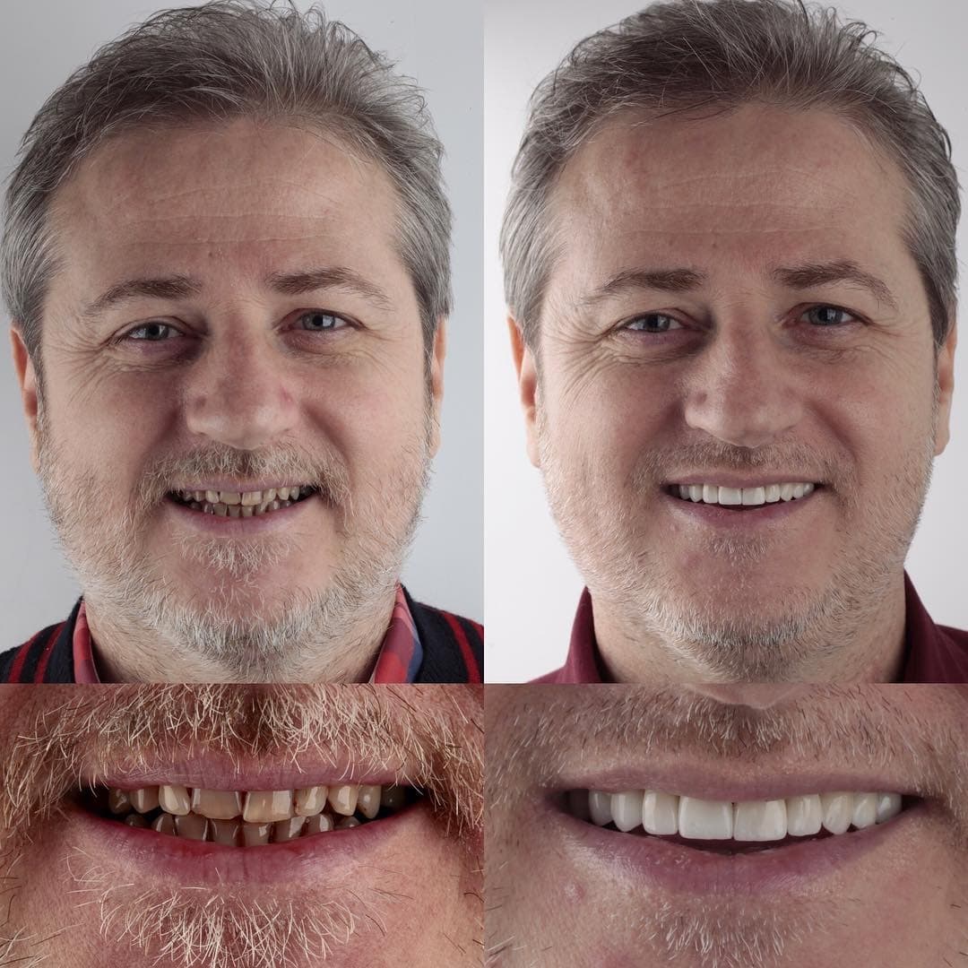 20 фотографий работ стоматолога, который даёт людям ещё одну причину улыбнуться 73