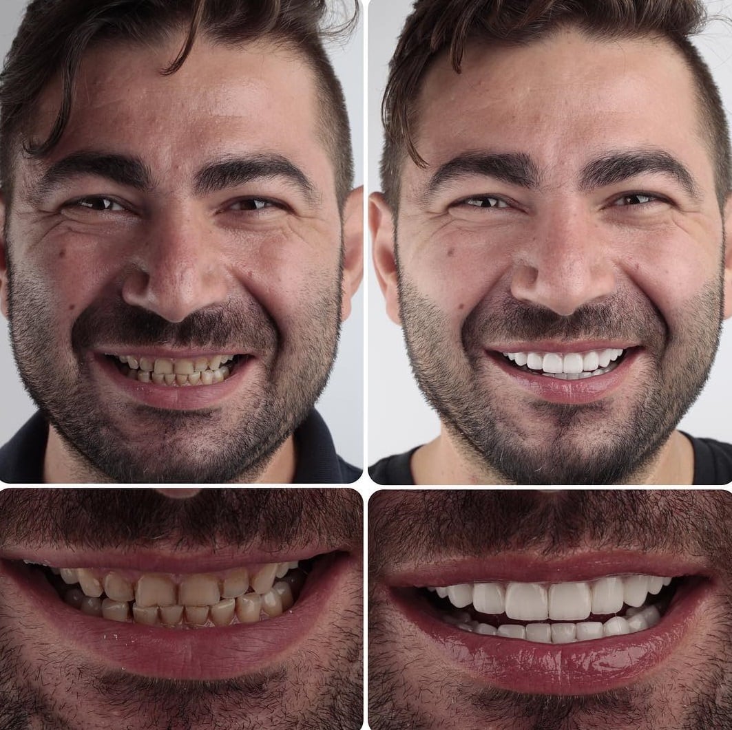 20 фотографий работ стоматолога, который даёт людям ещё одну причину улыбнуться 74