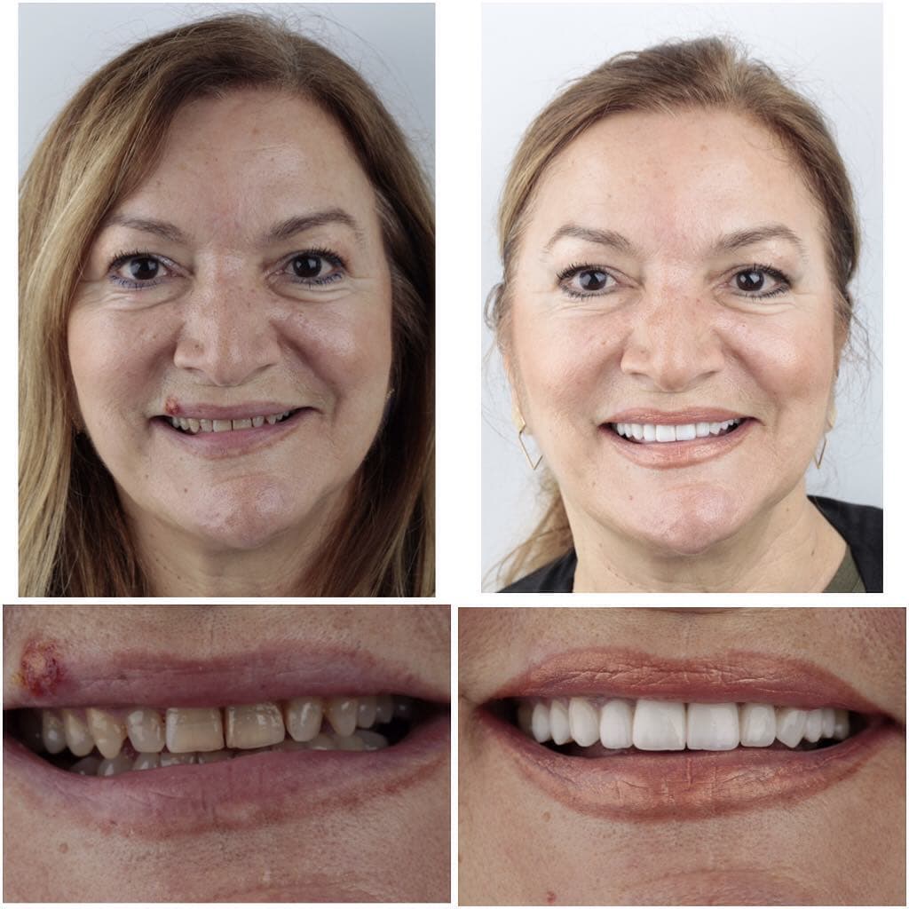 20 фотографий работ стоматолога, который даёт людям ещё одну причину улыбнуться 77