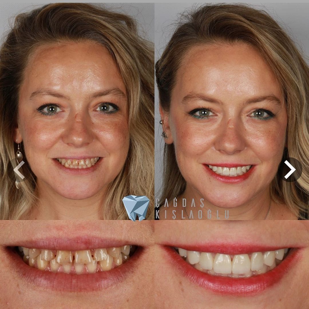 20 фотографий работ стоматолога, который даёт людям ещё одну причину улыбнуться 79