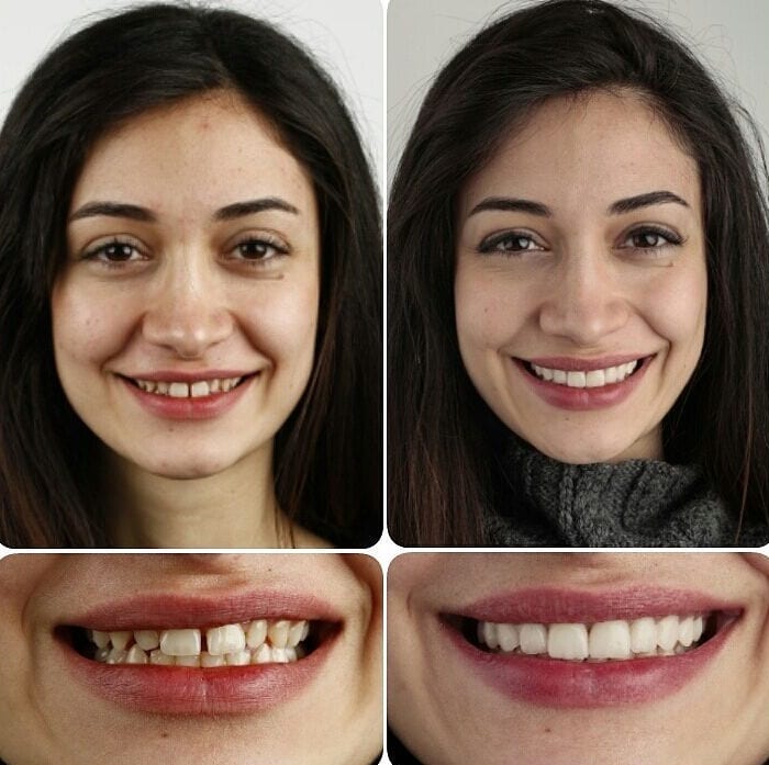 20 фотографий работ стоматолога, который даёт людям ещё одну причину улыбнуться 78