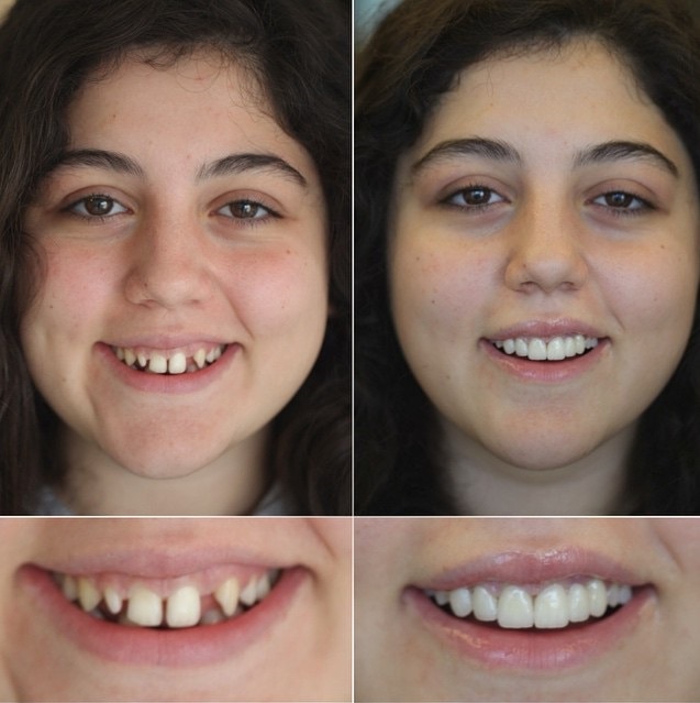 20 фотографий работ стоматолога, который даёт людям ещё одну причину улыбнуться 80