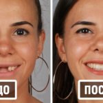 20 фотографий работ стоматолога, который даёт людям ещё одну причину улыбнуться