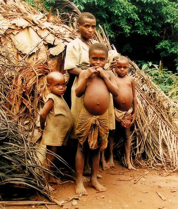 Почему у африканских детей большие животы 8
