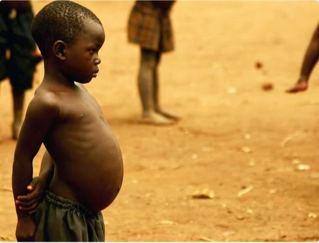 Почему у африканских детей большие животы 7