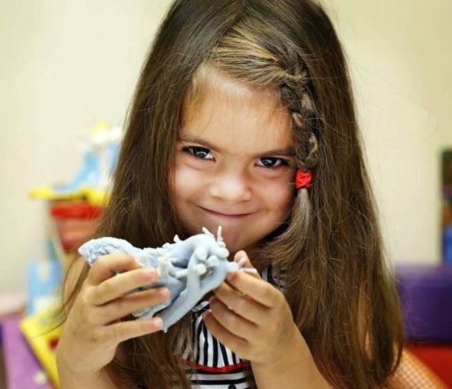 Сердце, напечатанное на 3D-принтере, спасло 4-летнюю Миа Гонсалес 8