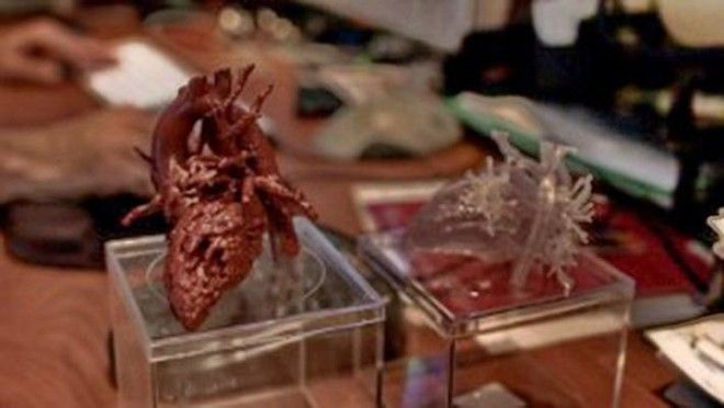 Сердце, напечатанное на 3D-принтере, спасло 4-летнюю Миа Гонсалес 7