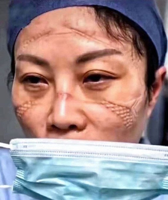 Врачи показали, как выглядят их лица после смен в больницах, где они помогают пациентам с коронавирусом 29