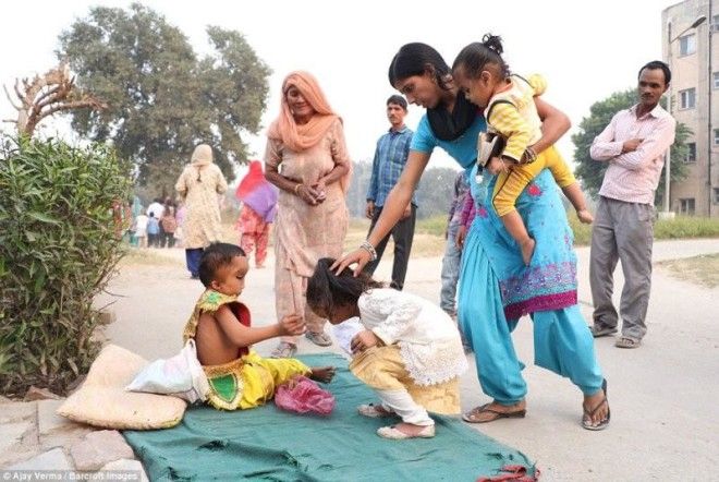 Жители индийской деревни поклоняются мальчику с деформированной головой как богу Ганеше 32