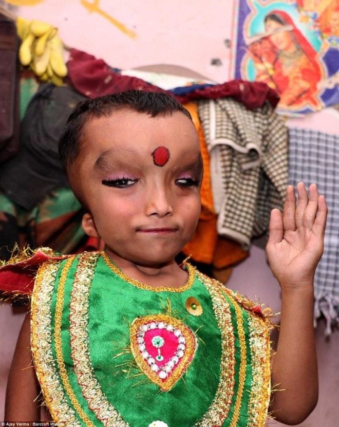 Жители индийской деревни поклоняются мальчику с деформированной головой как богу Ганеше 33