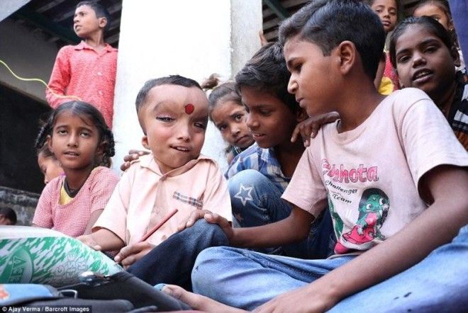 Жители индийской деревни поклоняются мальчику с деформированной головой как богу Ганеше 36